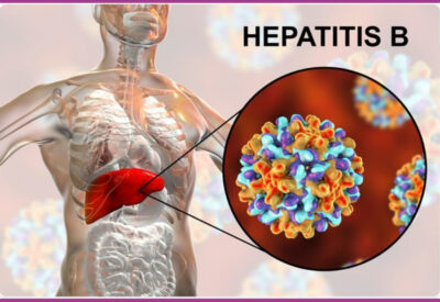 Hepatitis B and Liver Cancer Awareness
