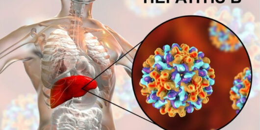 Hepatitis B and Liver Cancer Awareness