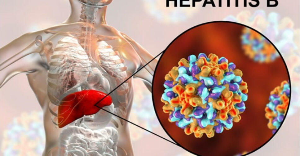 Hepatitis B and Liver Cancer Awareness